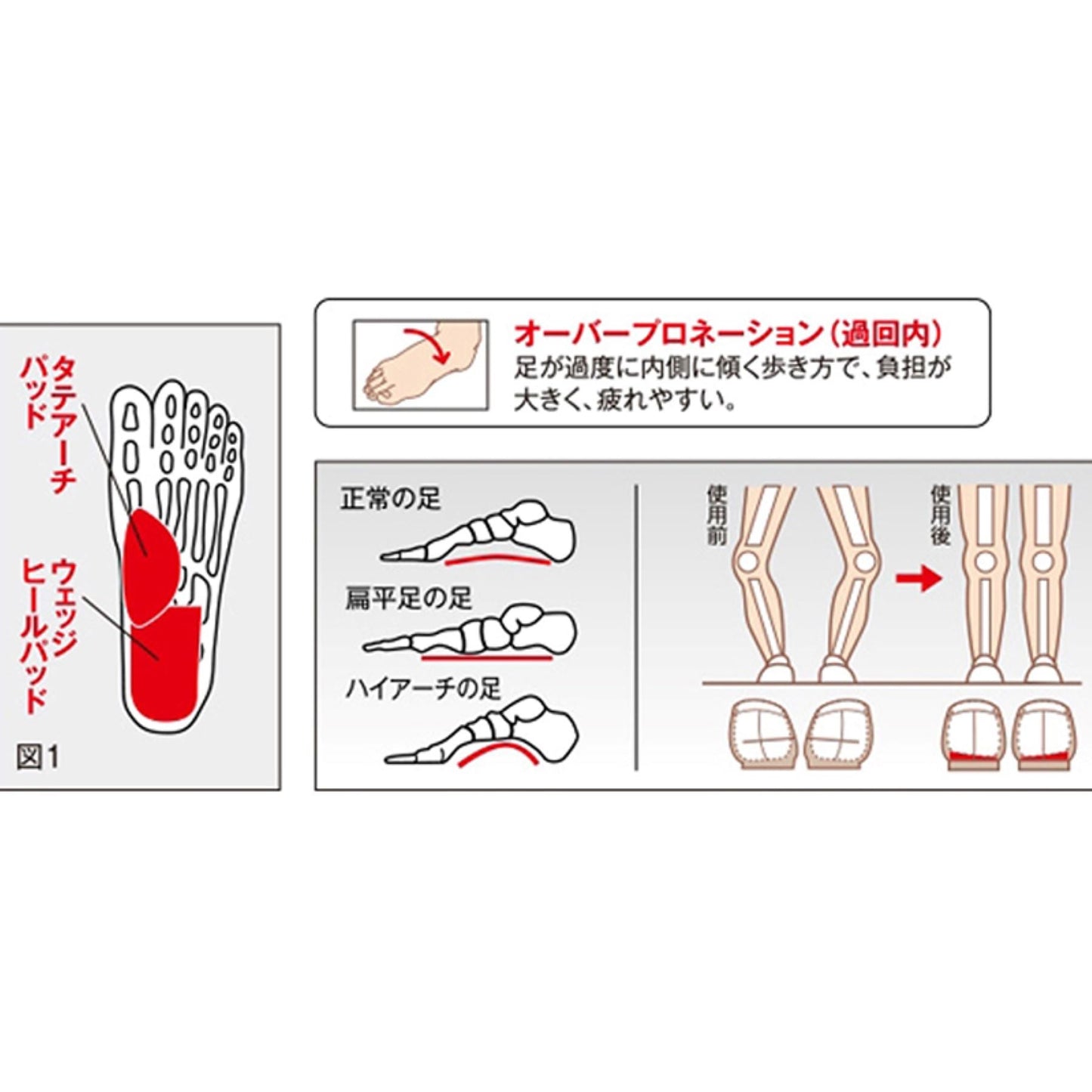 ソルボアーチウェッジヒールサポーター 薄型 L
