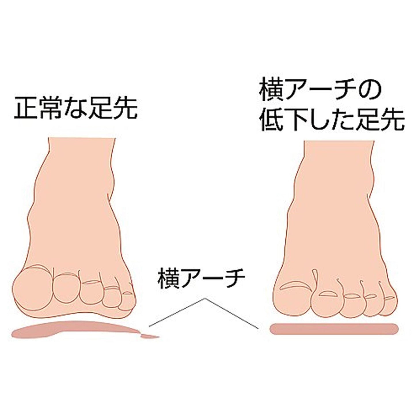 ソルボ ヨコアーチサポーター 薄型 L