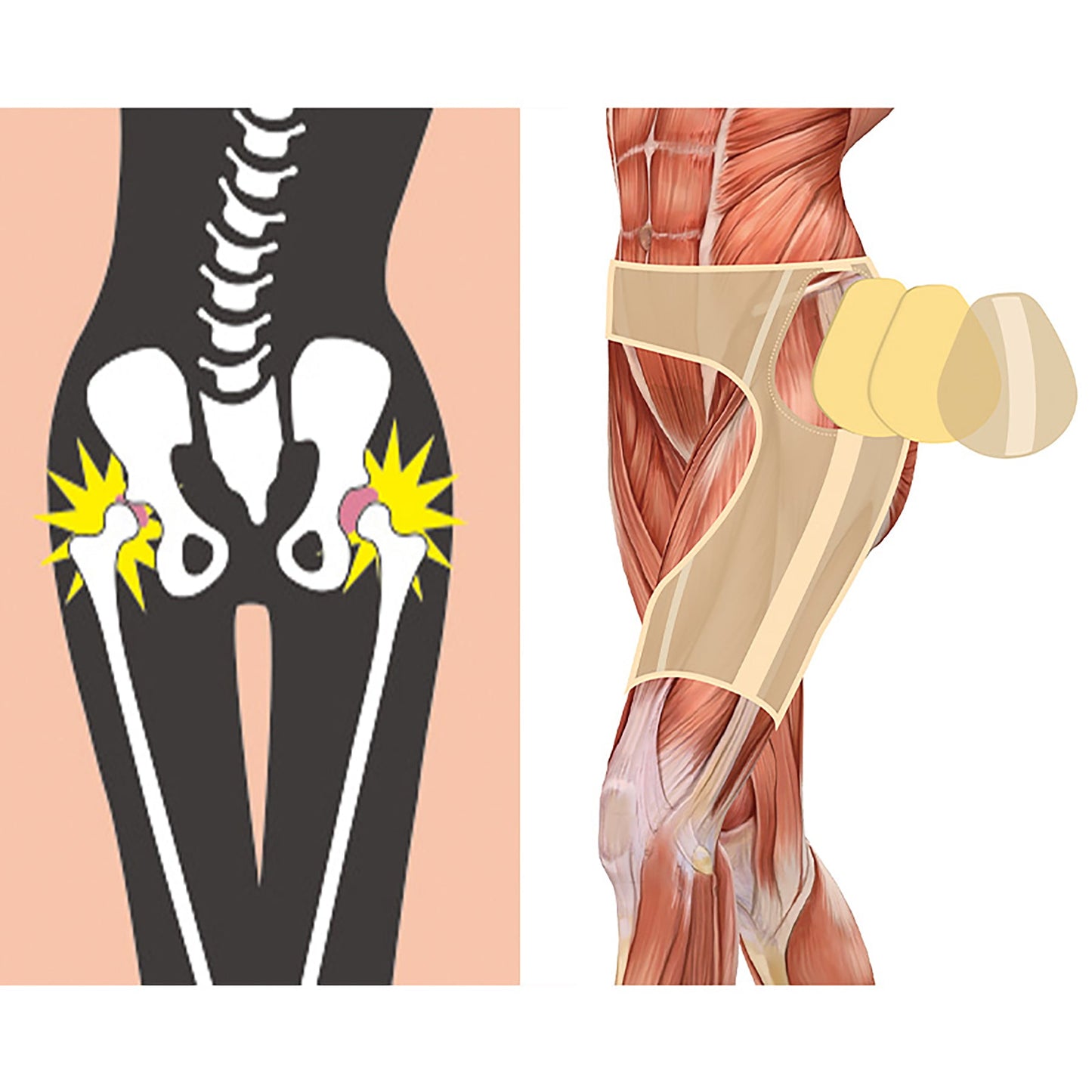 うす楽スイスイインナー股関節サポーター あったか痛み軽減 両足用 モカ S~M