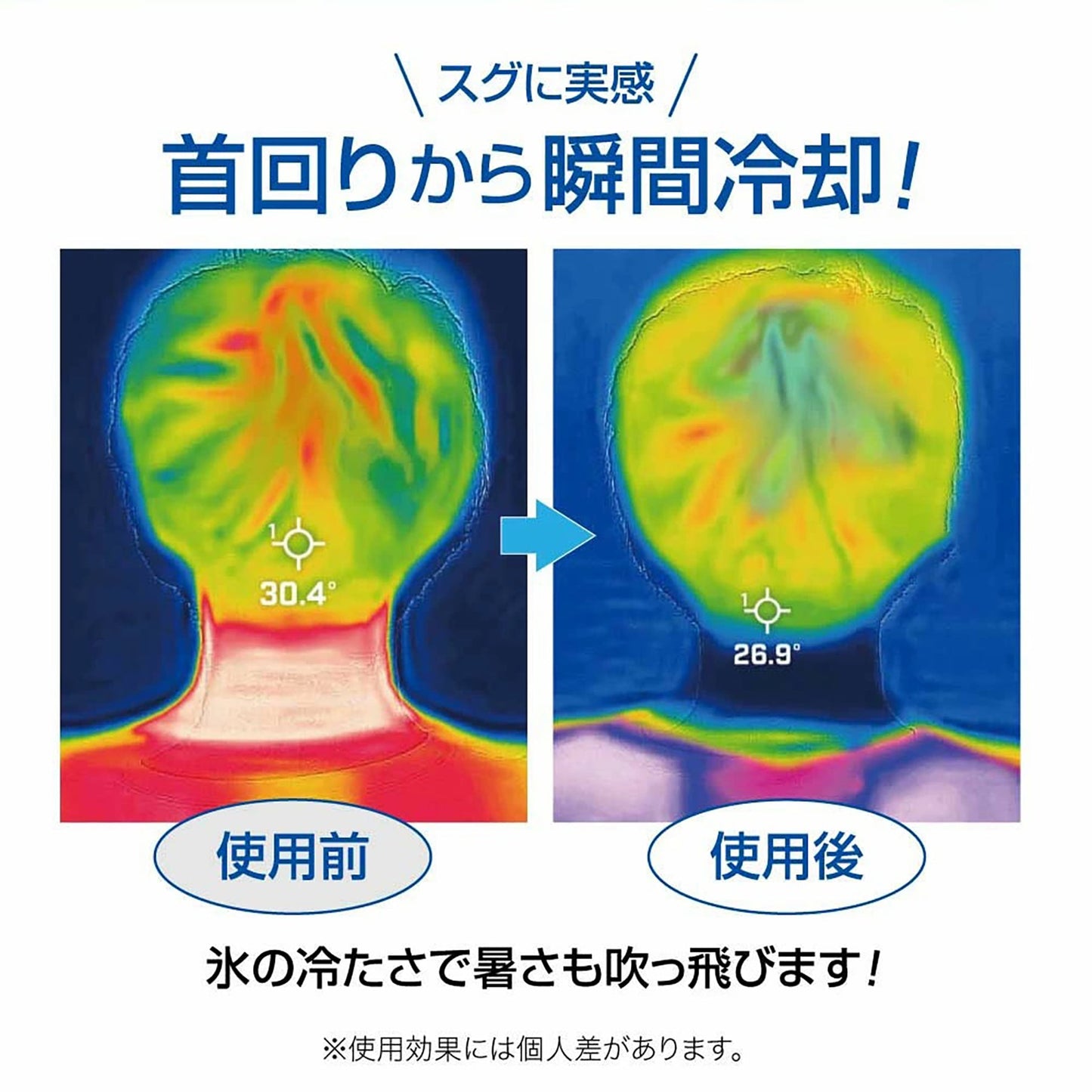 Ｕ－ＣＯＯＬ（ユークール）　ハンズフリーアイスパック　ブルー