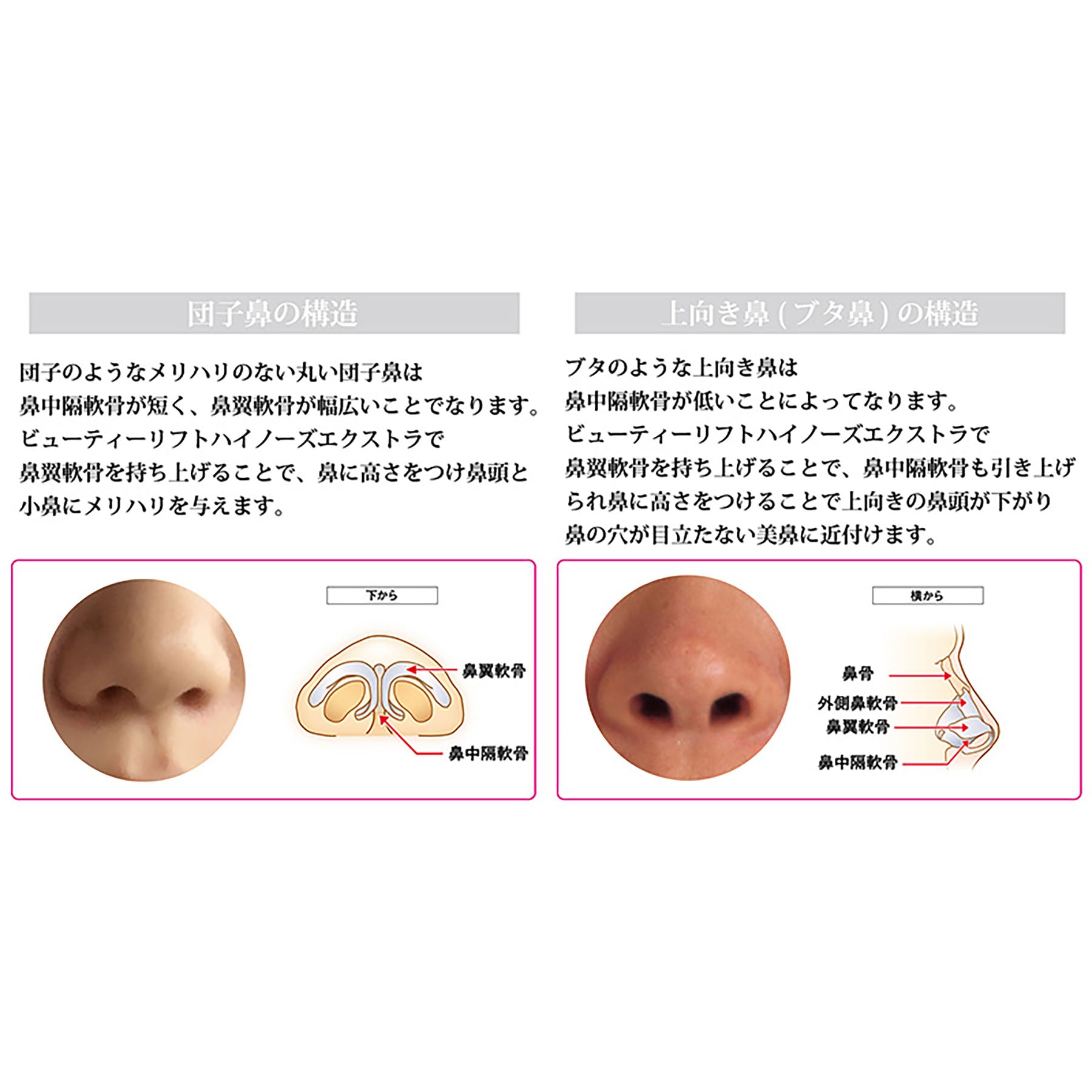 鼻翼 オムニ ビューティーリフトハイノーズエクストラ 鼻専用美容器 鼻矯正 痛くない – GREEN CROSS-select 工事現場の安全対策用品なら