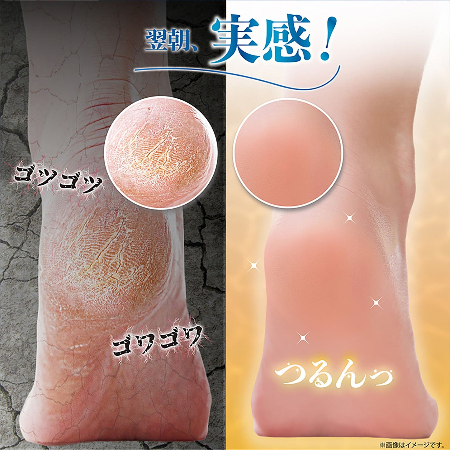 空気が通るつるピカソックス　カサカサ底マメ対策　ムレにくい　男女兼用　ブラック