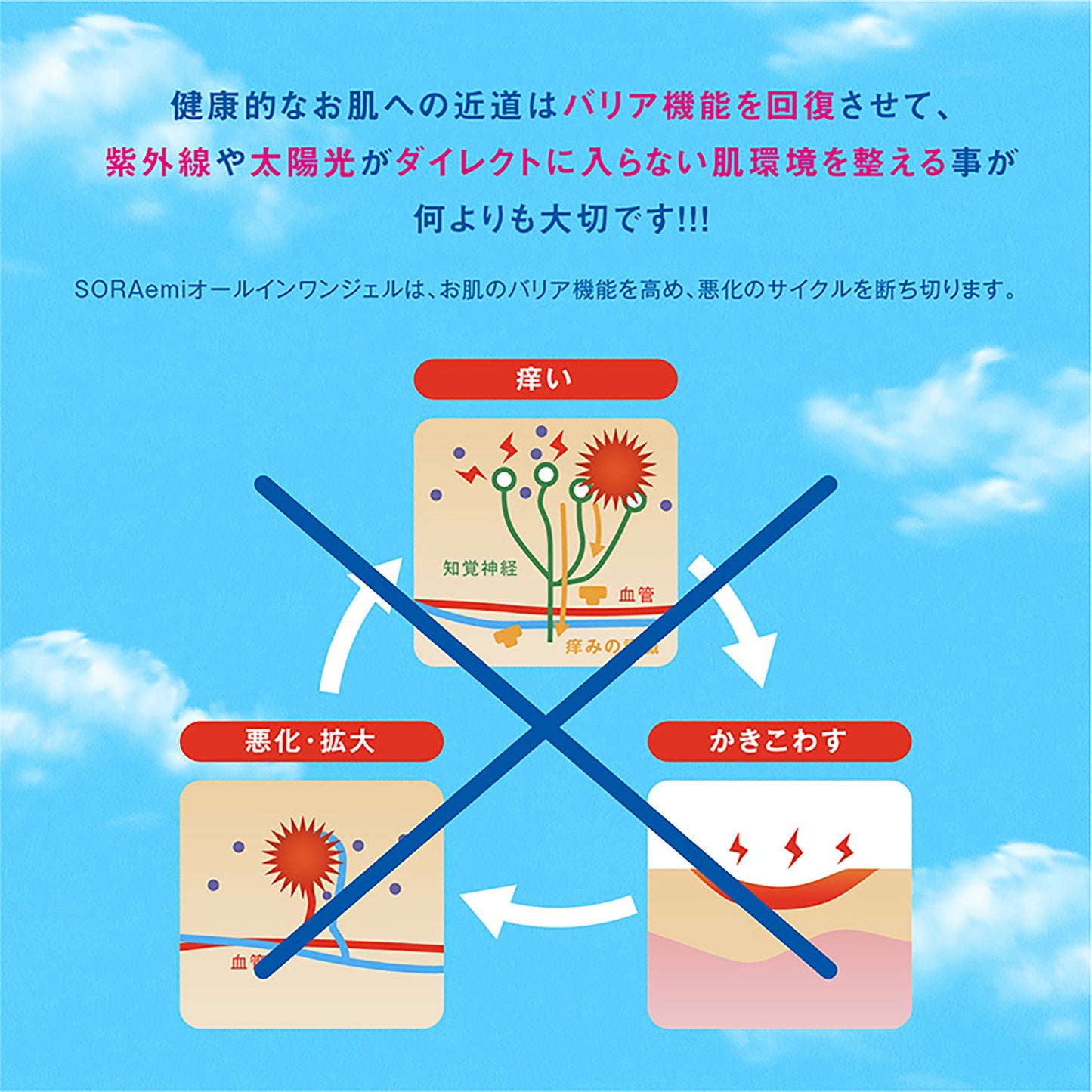 ＳＯＲＡｅｍｉ　オールインワンジェル　紫外線アレルギー日光過敏専用ケアジェル