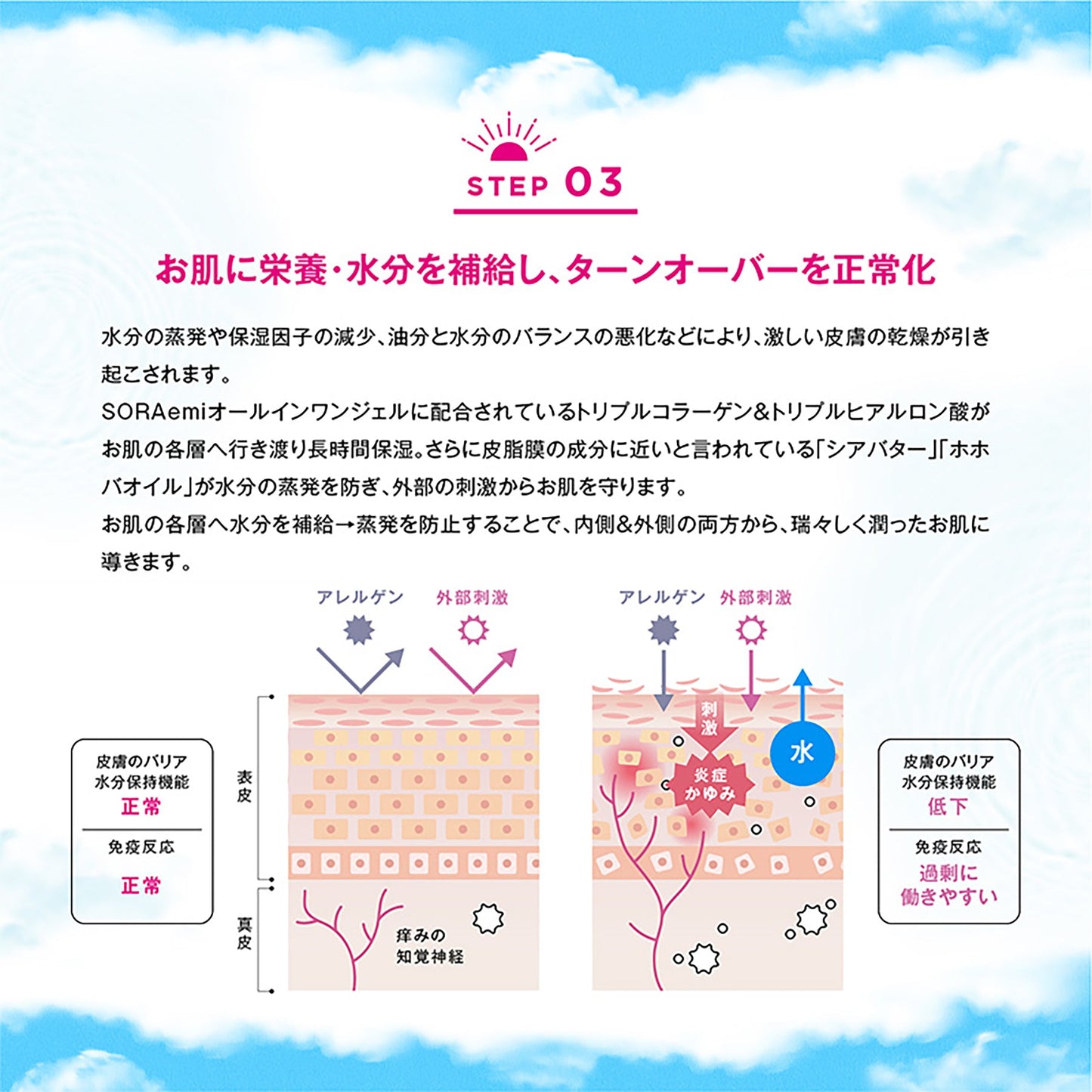 ＳＯＲＡｅｍｉ　オールインワンジェル　紫外線アレルギー日光過敏専用ケアジェル