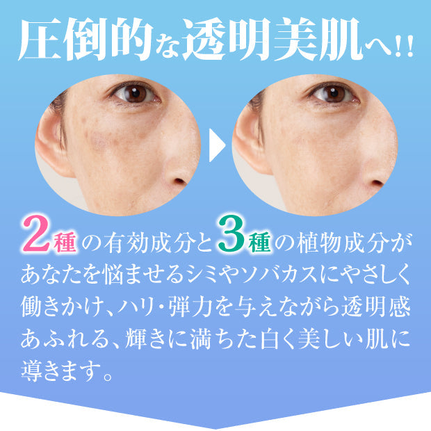 薬用　トラシーミZ　30g　シミケア【医薬部外品】