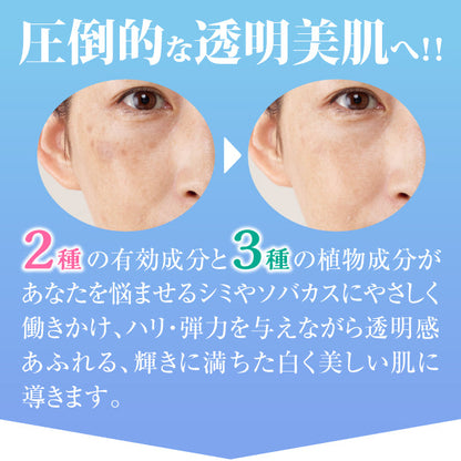 薬用　トラシーミZ　30g　シミケア【医薬部外品】