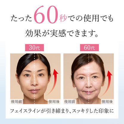 アメージングローラー　小顔　リフトアップ　自宅エステ　美顔器