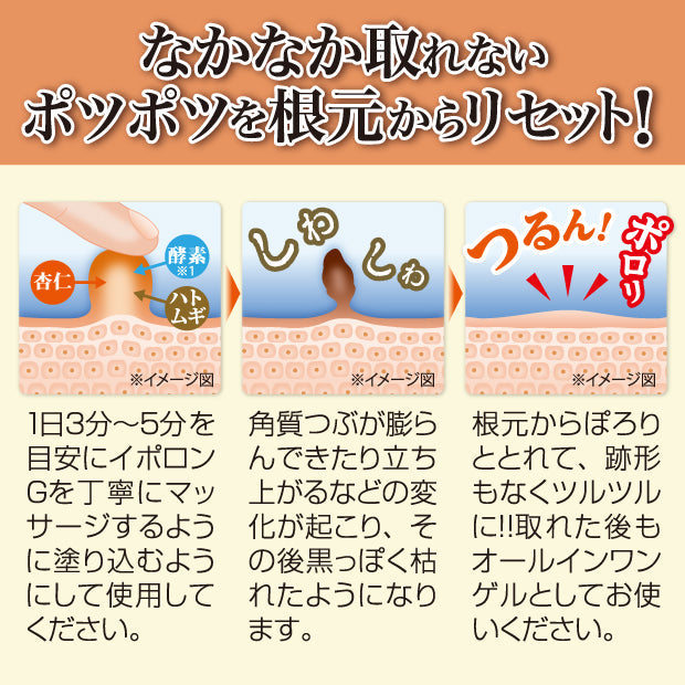 イポロン G　150g　浸透角質ケア　