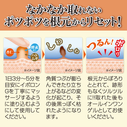イポロン G　150g　浸透角質ケア　
