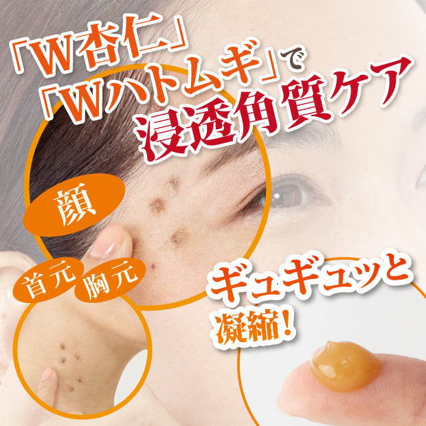 イポロン G　150g　浸透角質ケア　