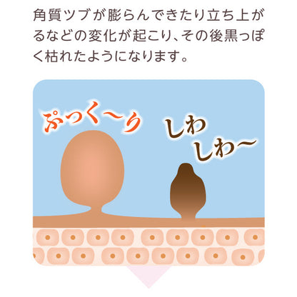 イポロンC 25g 角質ケア 顔・首元